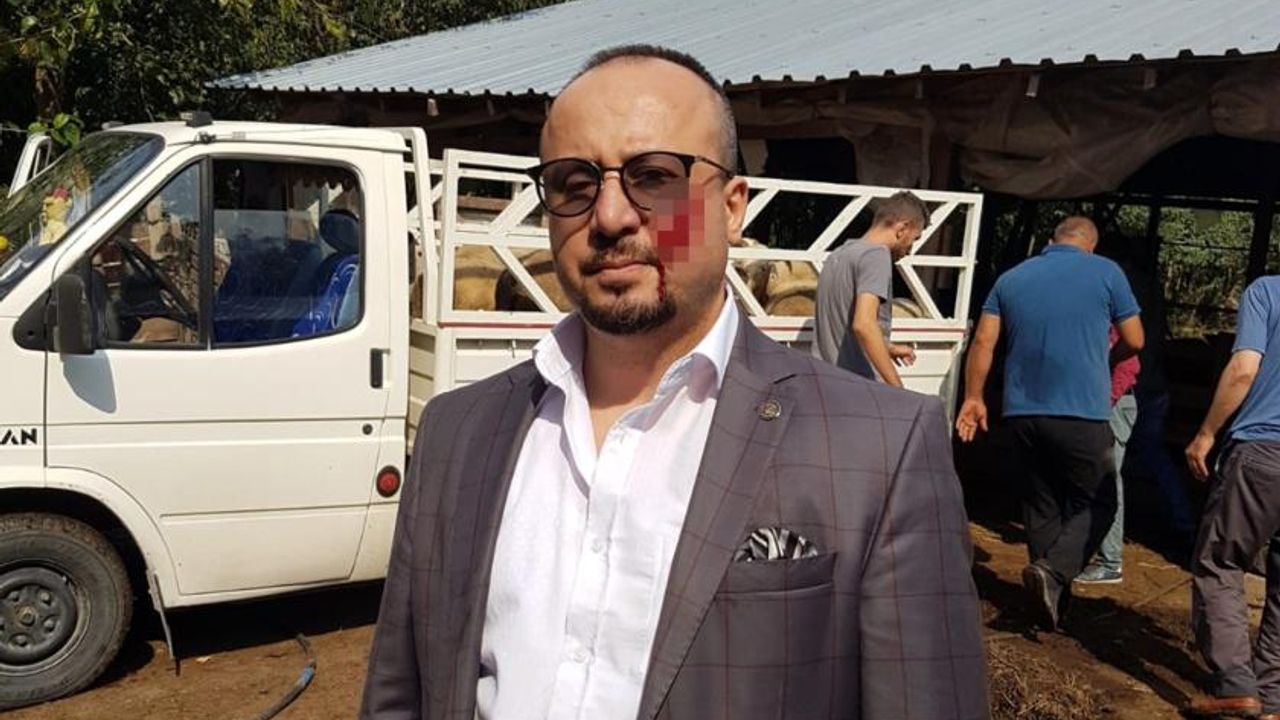 Hacze gelen avukatı ısırmıştı: Cezası açıklandı